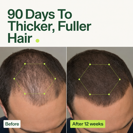 Densify+ Root Activating Serum