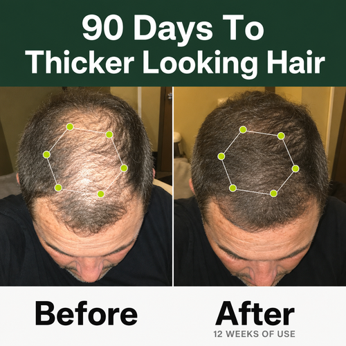 Densify+ Peptide Hair Growth Serum
