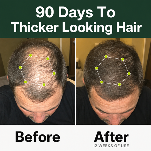 Densify+ Peptide Hair Growth Serum