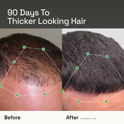 Densify+ Root Activating Serum