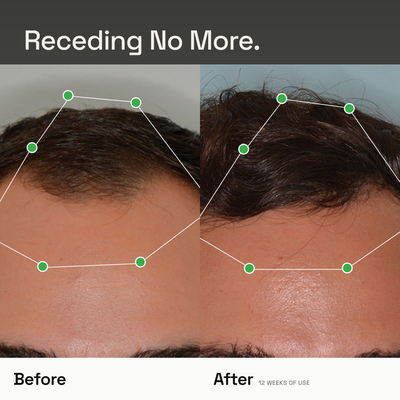 Densify+ Peptide Hair Growth Serum