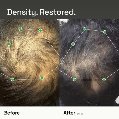Densify+ Peptide Hair Growth Serum