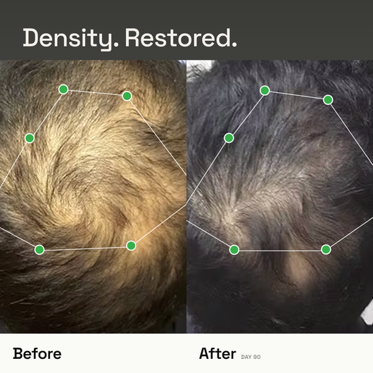 Densify+ Peptide Hair Growth Serum